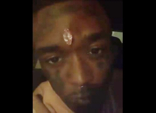 미국 가수 릴 우지 버트가 공개한 이마에 박힌 다이아몬드[릴 우지 버트 트위터 캡처]